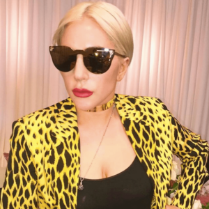 Lady-Gaga-Autoimun-Lupus